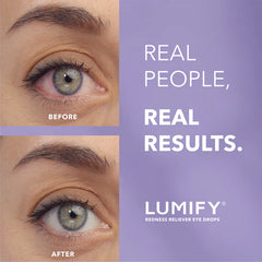 LUMIFY Redness Reliever Eye Drops (7.5mL)